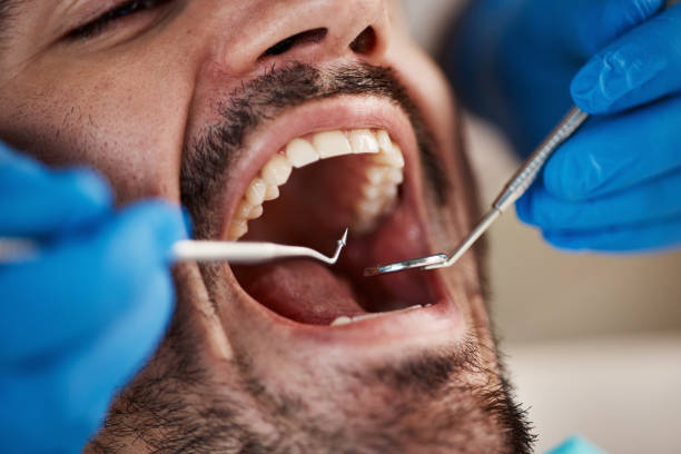 Best Mobile Emergency Dentist in Mikes, TX